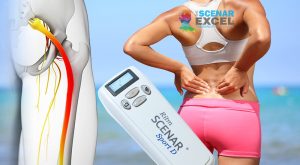SCENAR training for sciatica