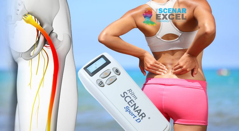 SCENAR training for sciatica
